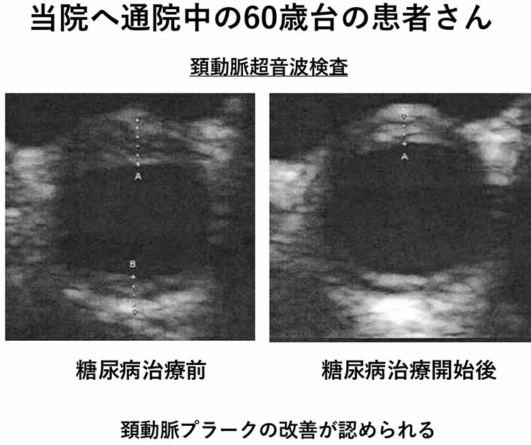当院へ通院中の60歳台の男性患者さん